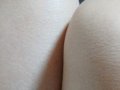 ---